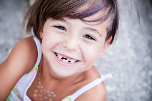 Little girl with big smile and missing teeth