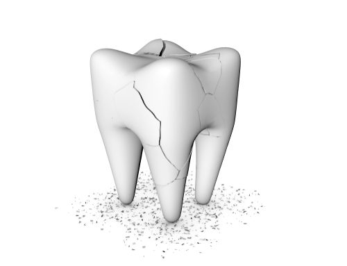 Cracked Teeth: What Can Happen to Them and What Can Be Done to Fix Them?