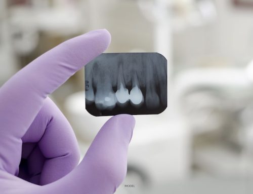 Are Dental X-Rays Safe?